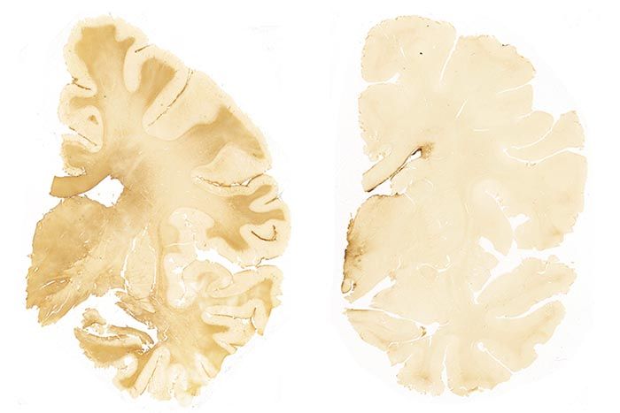 brain image