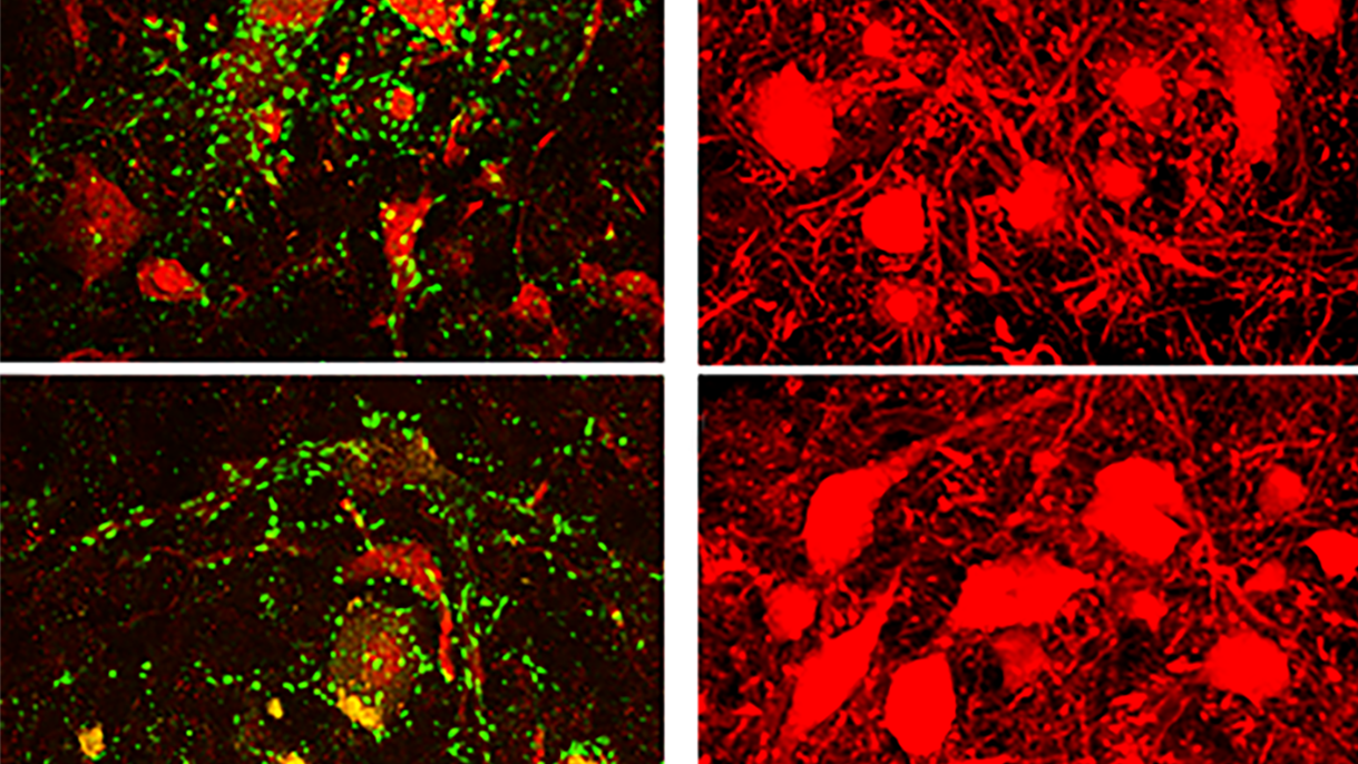 old-motor-neurons-don-t-die-scientists-discover-they-just-slow-down