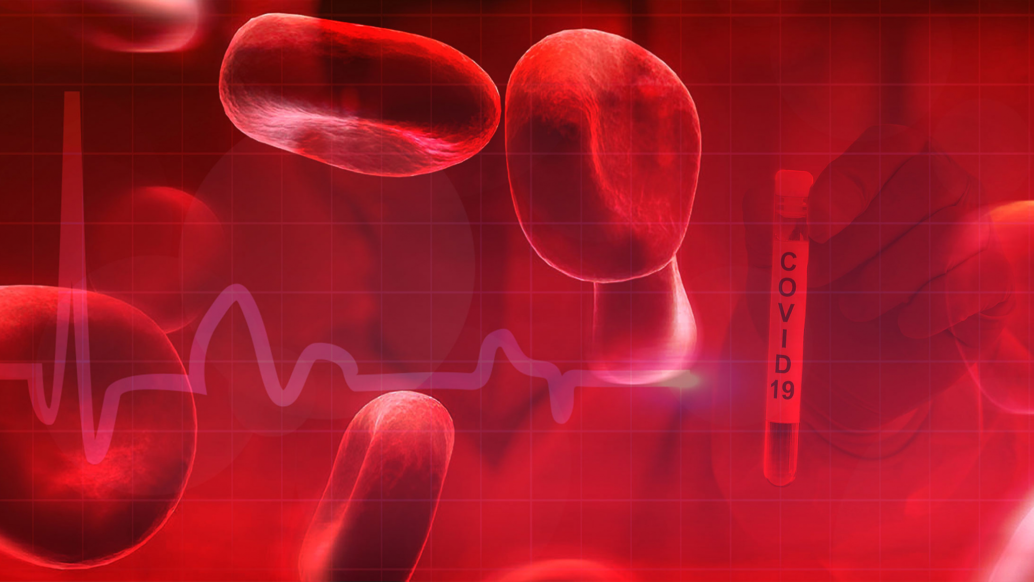 secondary-bloodstream-infections-associated-with-severe-covid-19